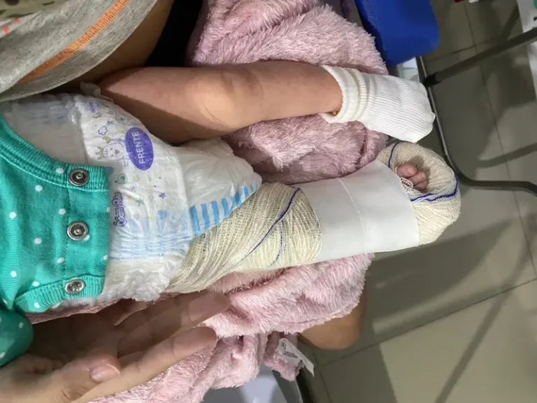 Família acusa Hospital de negligência após bebê ter fêmur quebrado durante parto em Floriano
