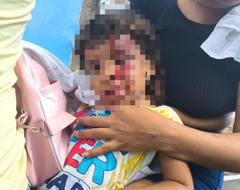 Criança é atingida por tijolo na cabeça durante briga entre homens em Teresina